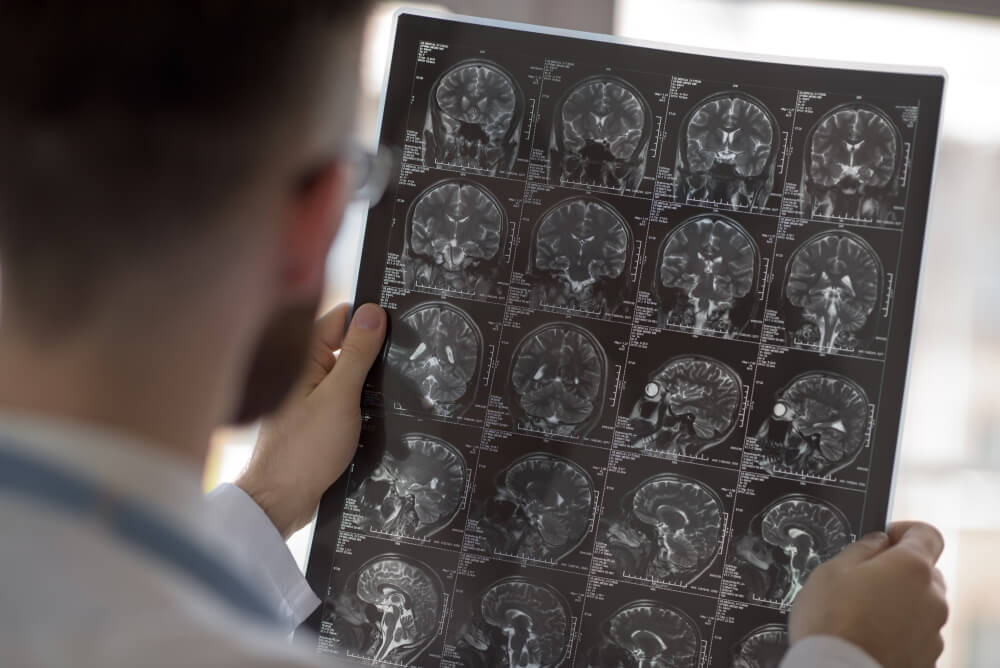 Hier Is Alles Wat U Moet Weten Over Ct- En Mri-Beeldvorming | Postdicom