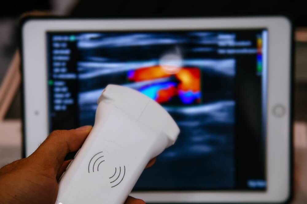 Portable Ultrasound Machines for Home or Clinic Use