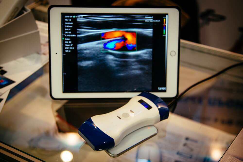 Portable Ultrasound Machines for Home or Clinic Use