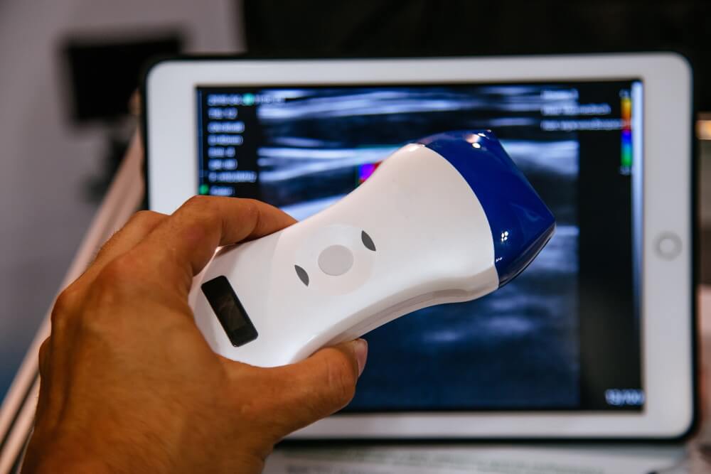 machine portative d'ordinateur portable de scanner d'ultrasons