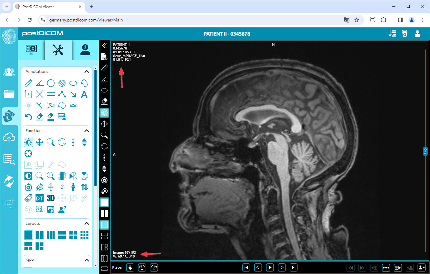 Showing/Hiding Patient Information on Viewport